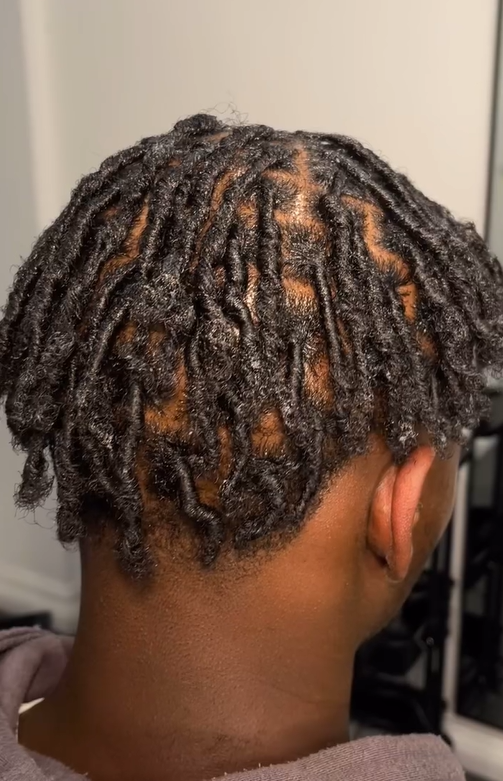 LOCS